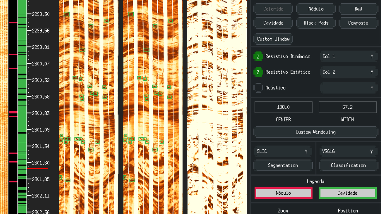 Automated Image Log Analysis With Petrobras